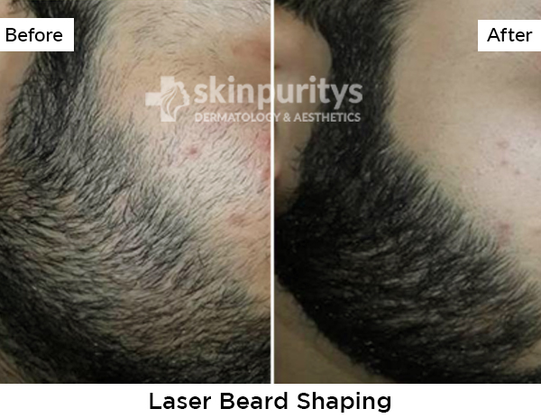Beard Shaping results